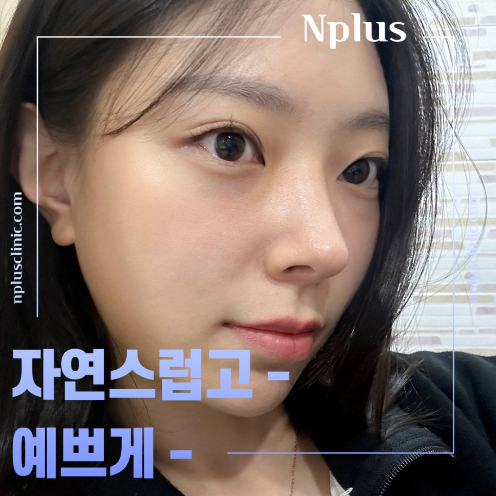 들창코성형 후기를 비교해 보고 관련 이미지 5
