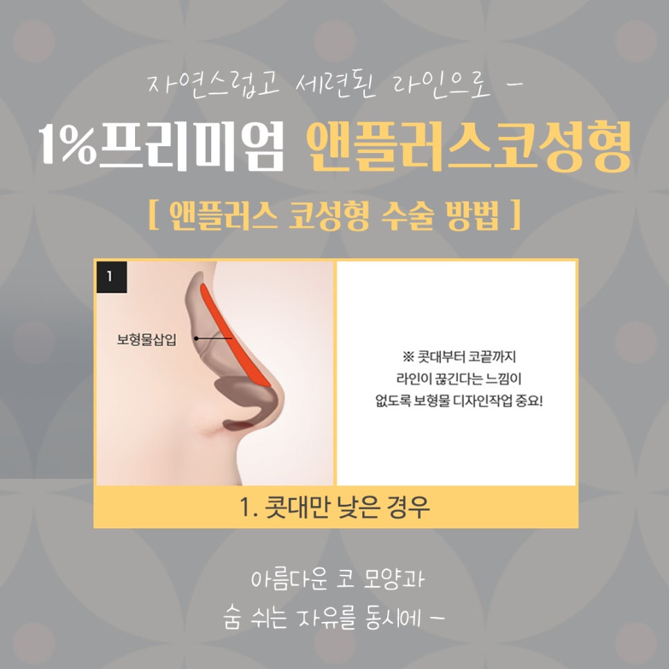 자가늑연골코수술 세련된 이미지로 관련 이미지 9