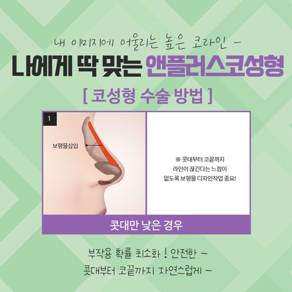 Check the Difference Before and After Rhinoplasty image 9