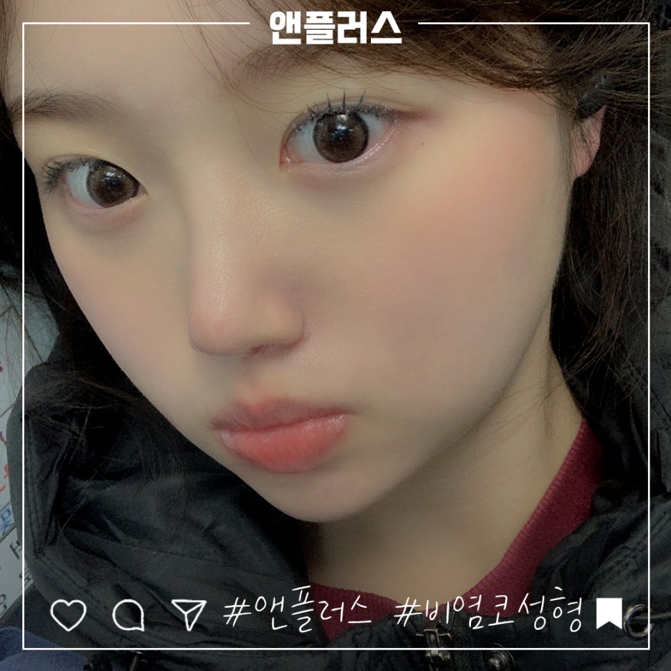 비염코성형후기 원인을 자세하게 알아보고 관련 이미지 12