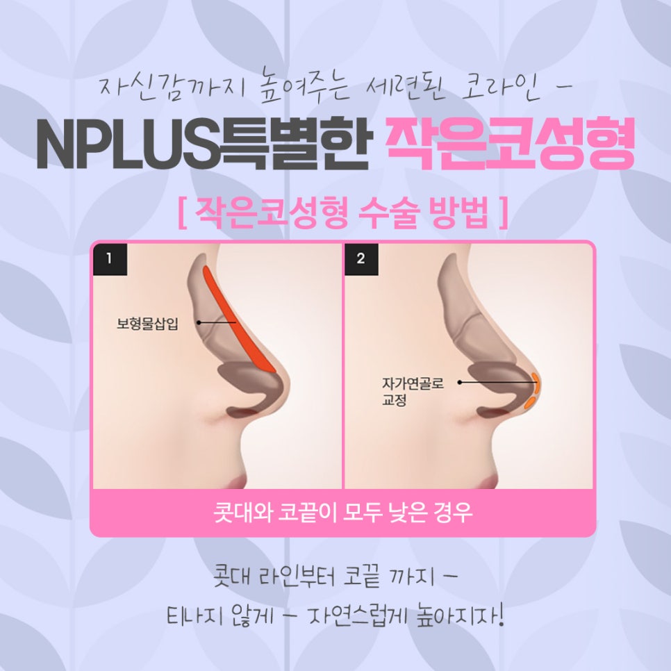 Review of Small Nose Rhinoplasty: Learn About It Carefully image 8