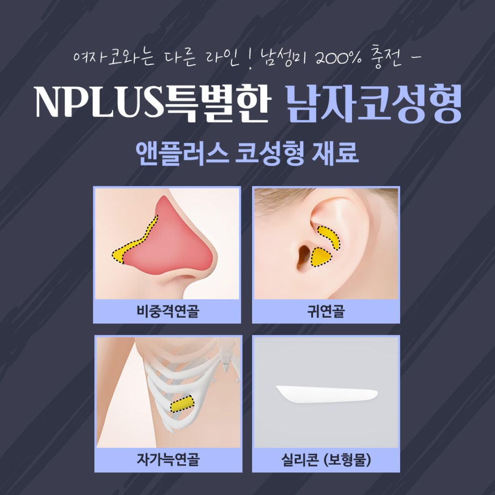 Rhinoplasty Review for Improving a Large Male Nose image 11