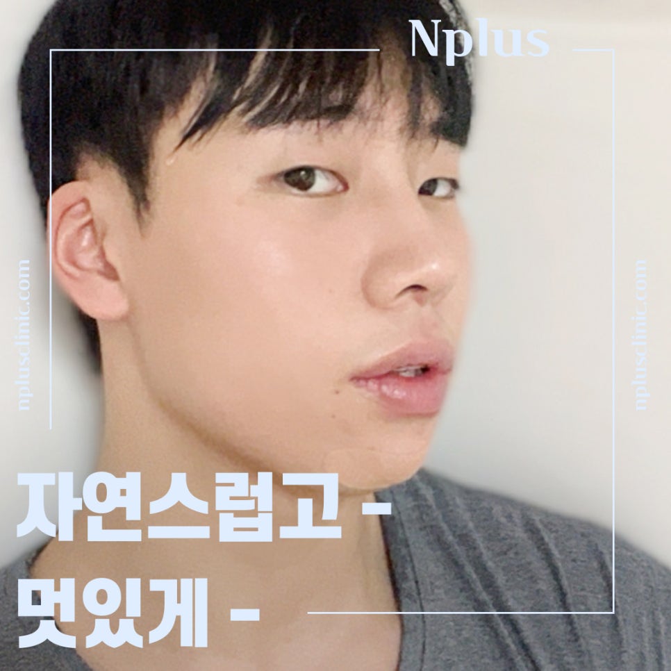 남자코성형전후 비교해 보고 관련 이미지 2
