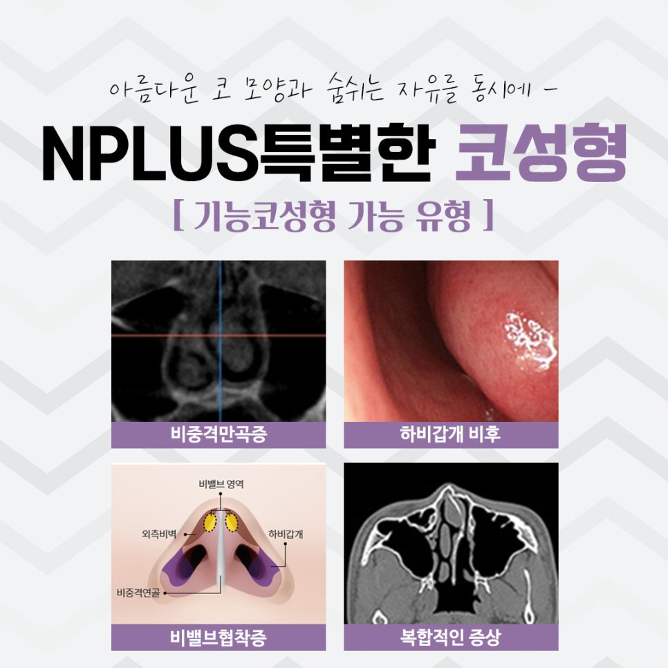 Before and After Nose Surgery: Looking into It Carefully image 5