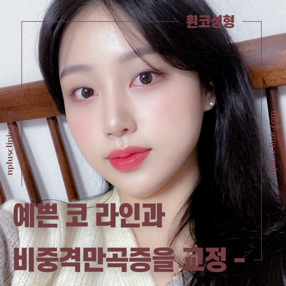 🍁가을엔 앤플러스의원 코성형 이벤트🍁 관련 이미지 6
