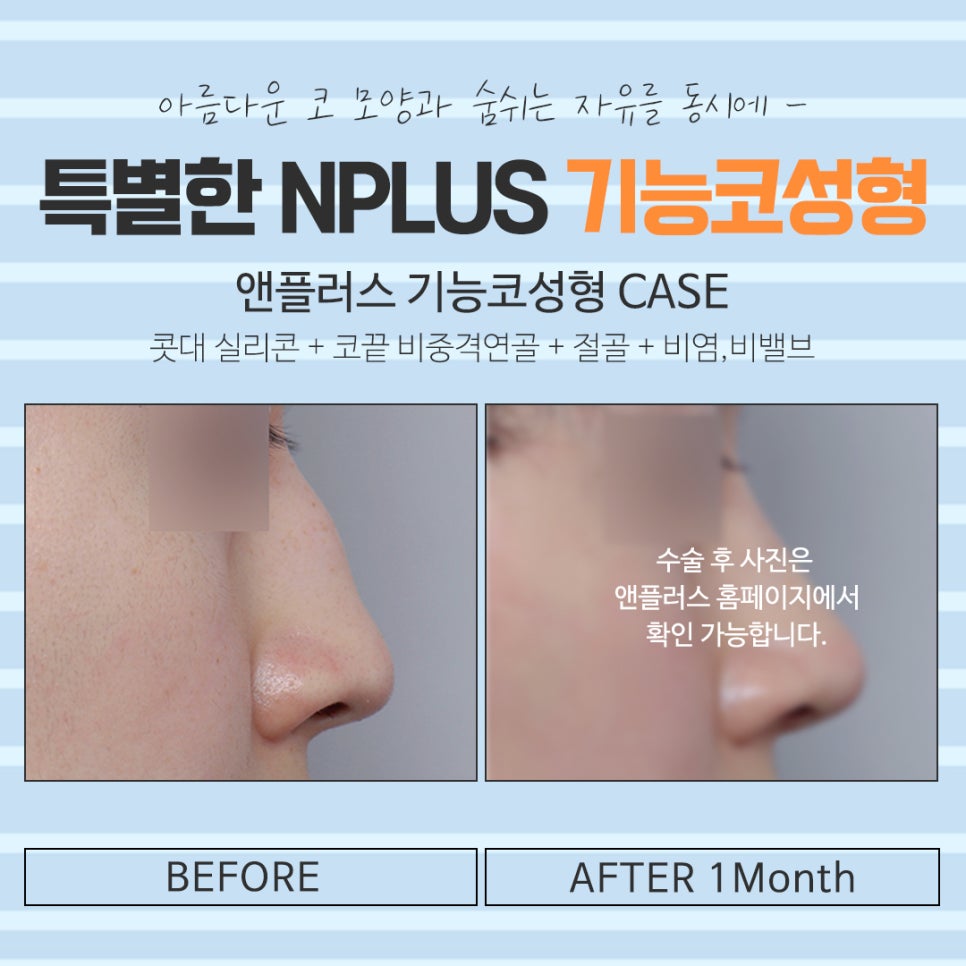 기능코수술실비 확실하게 알아보고 관련 이미지 16