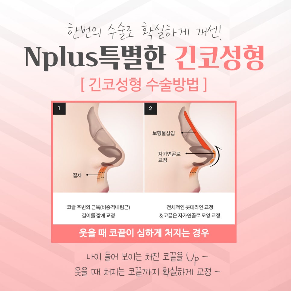 Learn More About Long Nose Surgery in Detail image 9