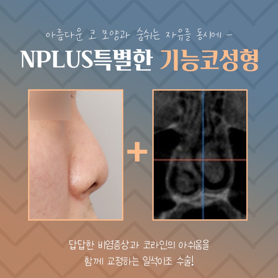 기능코후기에 대한 비교를 찾아보고 관련 이미지 3