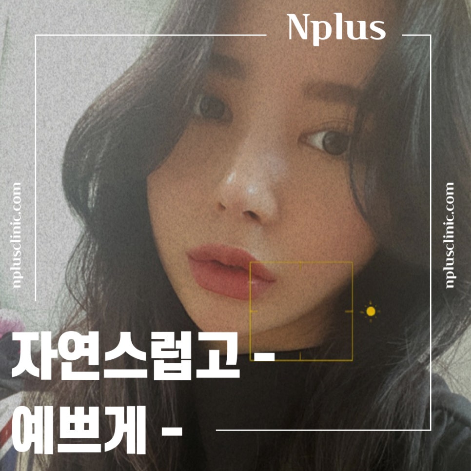 짧은코성형후기 자연스럽고 예쁘게 관련 이미지 1