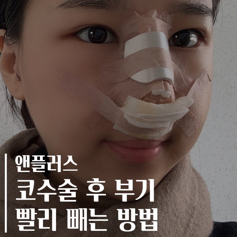 How to Reduce Swelling Quickly After Nose Surgery! image 1