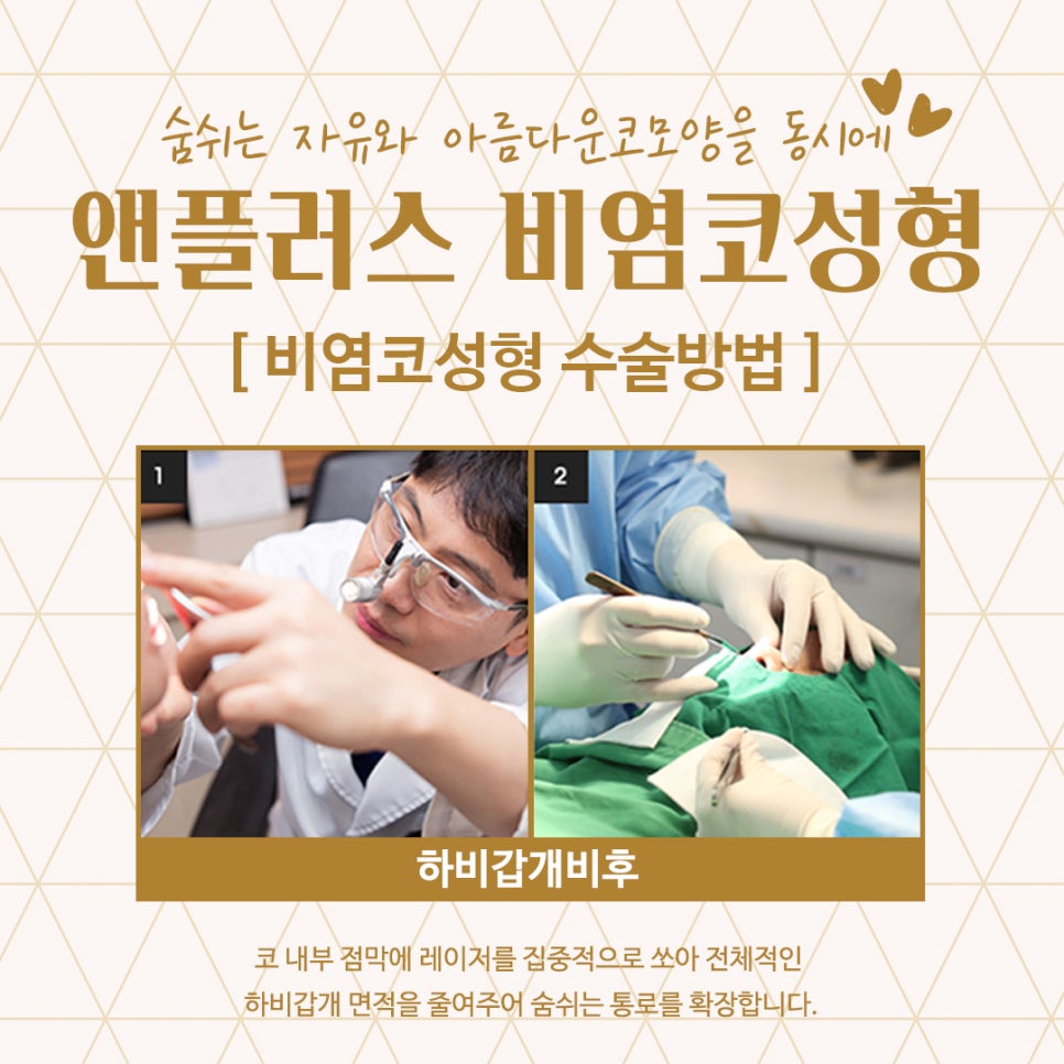 비염코성형후기 예쁜코라인을 생각하면서 관련 이미지 10
