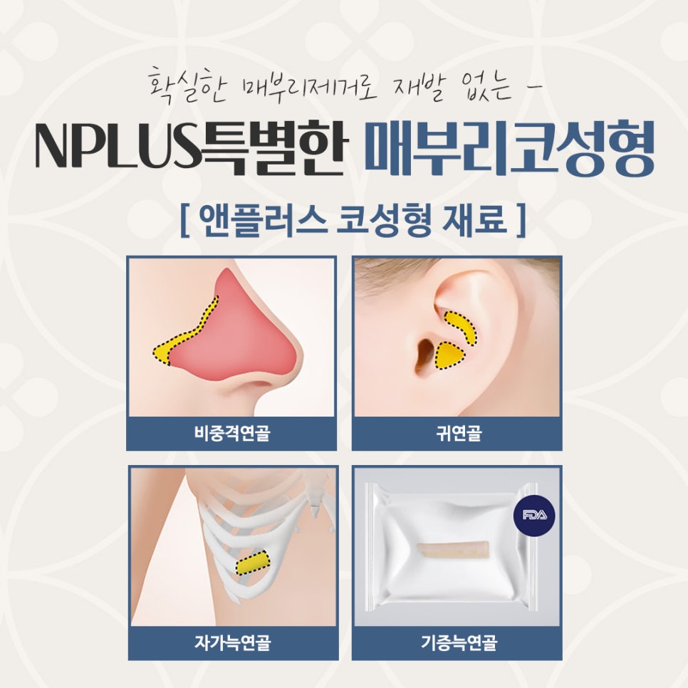 매부리코수술 후기까지 상세하게 알아보고 관련 이미지 11