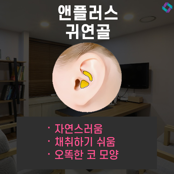 낮은코수술 자연스러운 앤플러스 관련 이미지 5