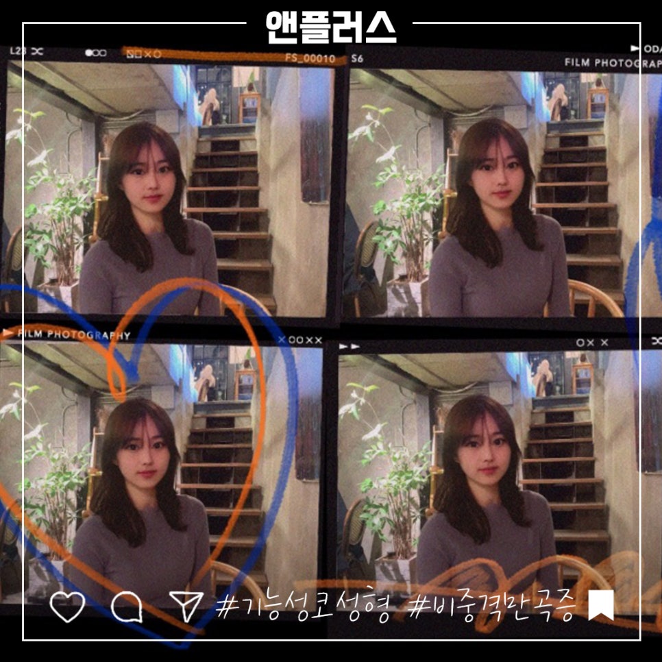 비중격만곡증수술 원인을 자세하게 관련 이미지 2