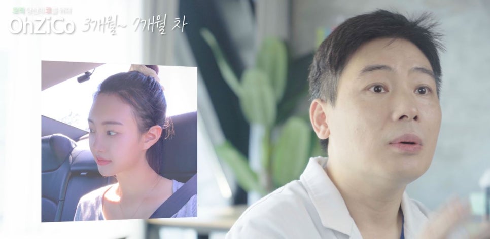 짧은코수술 후기까지 자세하게 알아보고 관련 이미지 26