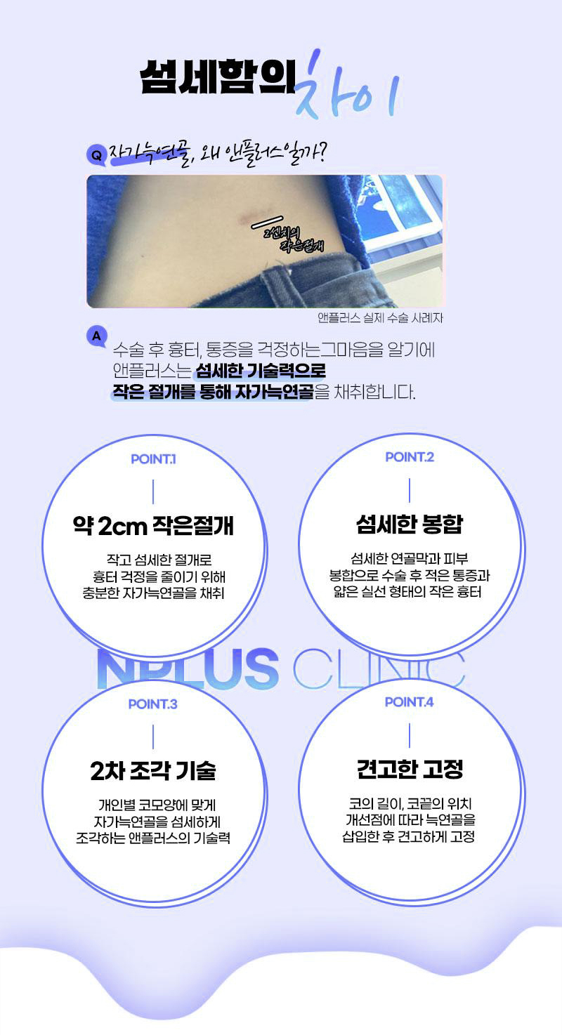첫코성형 차이를 확인한다면 관련 이미지 9