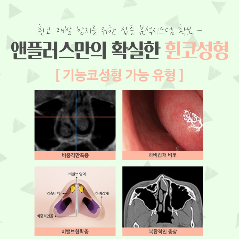 휜코성형후기 자세하게 알아보고 관련 이미지 6