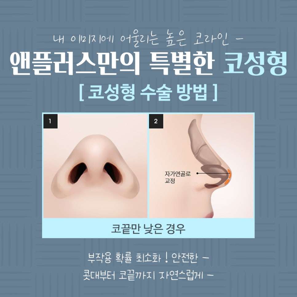 코수술전후 기능까지 확인하고 관련 이미지 10
