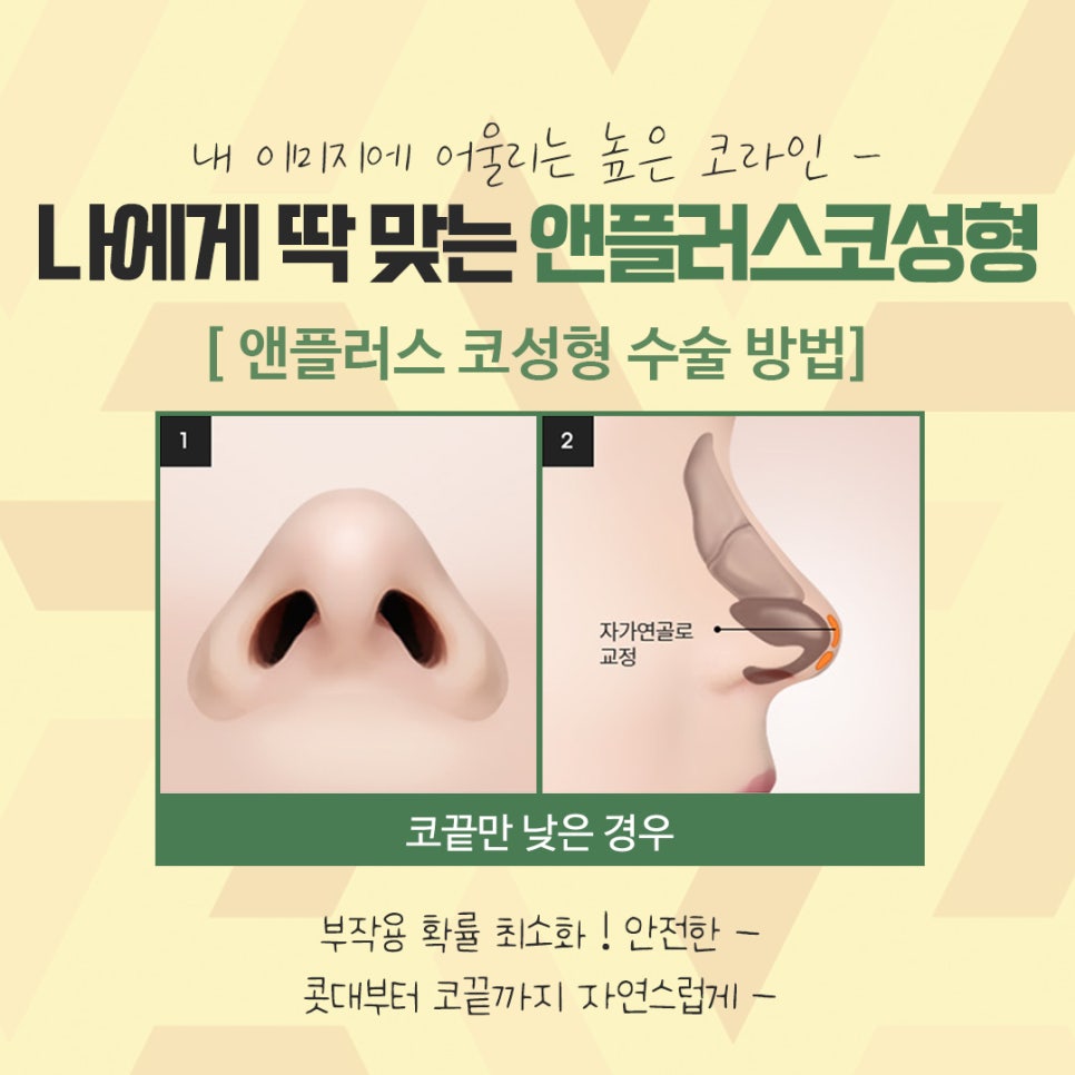 Nose Surgery Review Using Autologous Cartilage image 10
