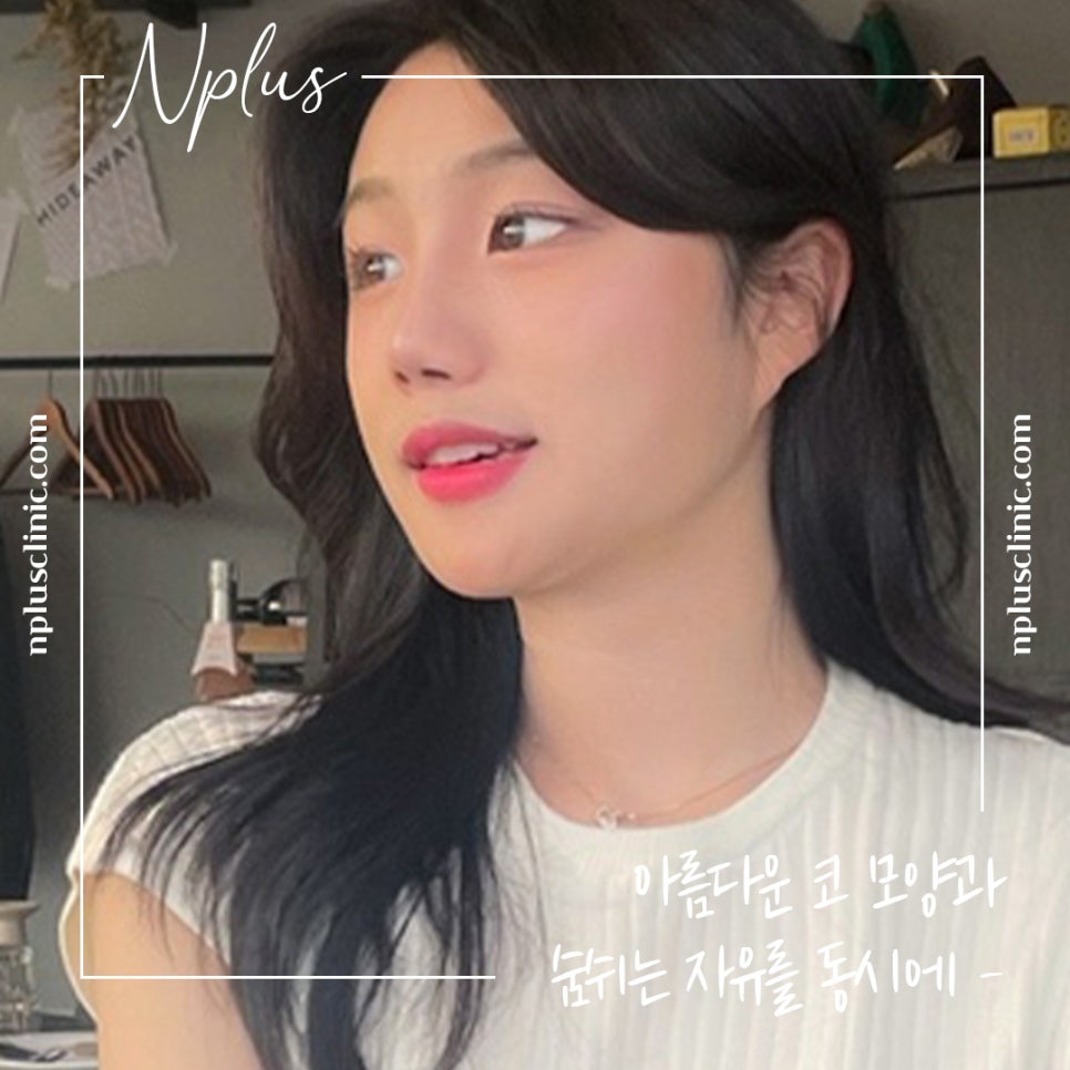 콧볼축소수술후기에 대해 알아보고 결정 관련 이미지 2