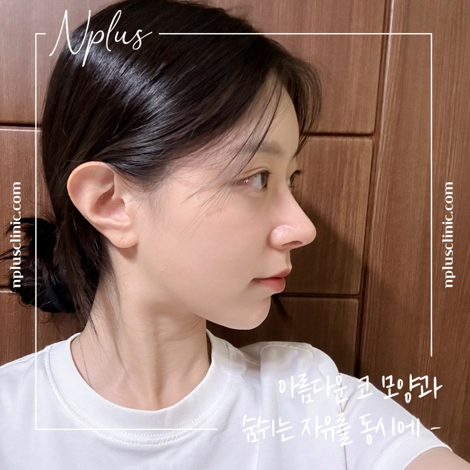 Looking at the Differences in Nose Tip Surgery Reviews image 3