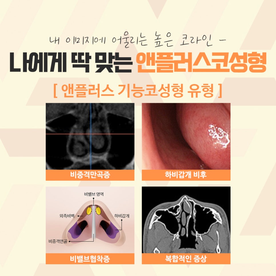 자가연골코수술을 통한 이미지 개선 관련 이미지 11