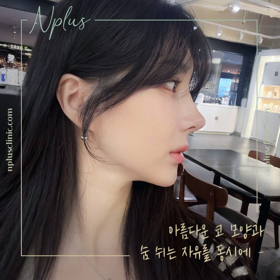 자가늑코성형 정확한 포인트를 파악하여 관련 이미지 1