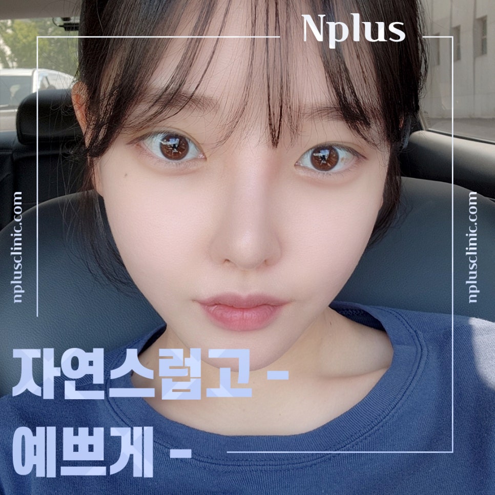 기능코성형 후기 보고 비교하여 관련 이미지 12