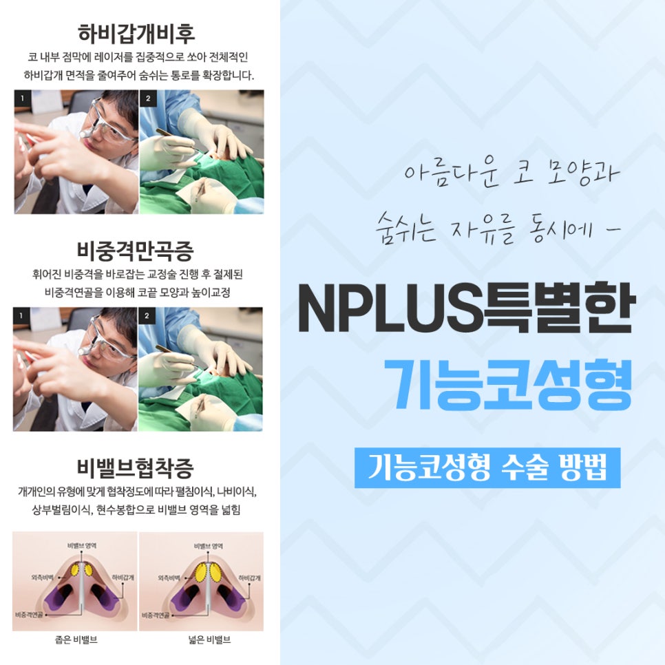 기능코성형후기를 신중하게 알아보고 관련 이미지 9