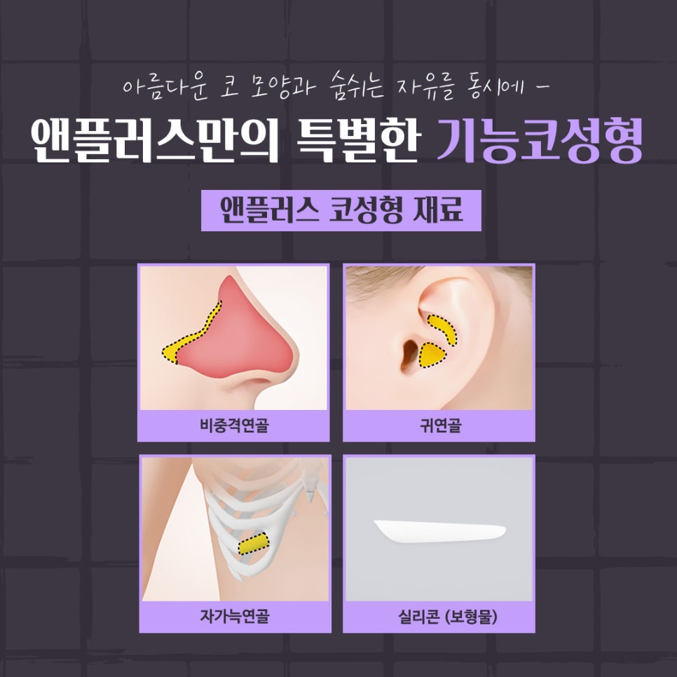 코성형후기 만족스러운 결과 관련 이미지 10