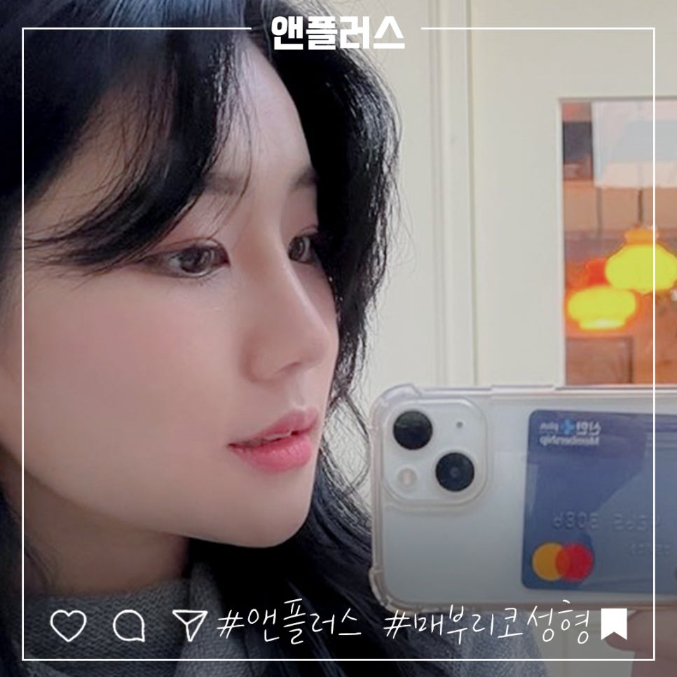 매부리코성형후기 정확한 진단을 통해 관련 이미지 8