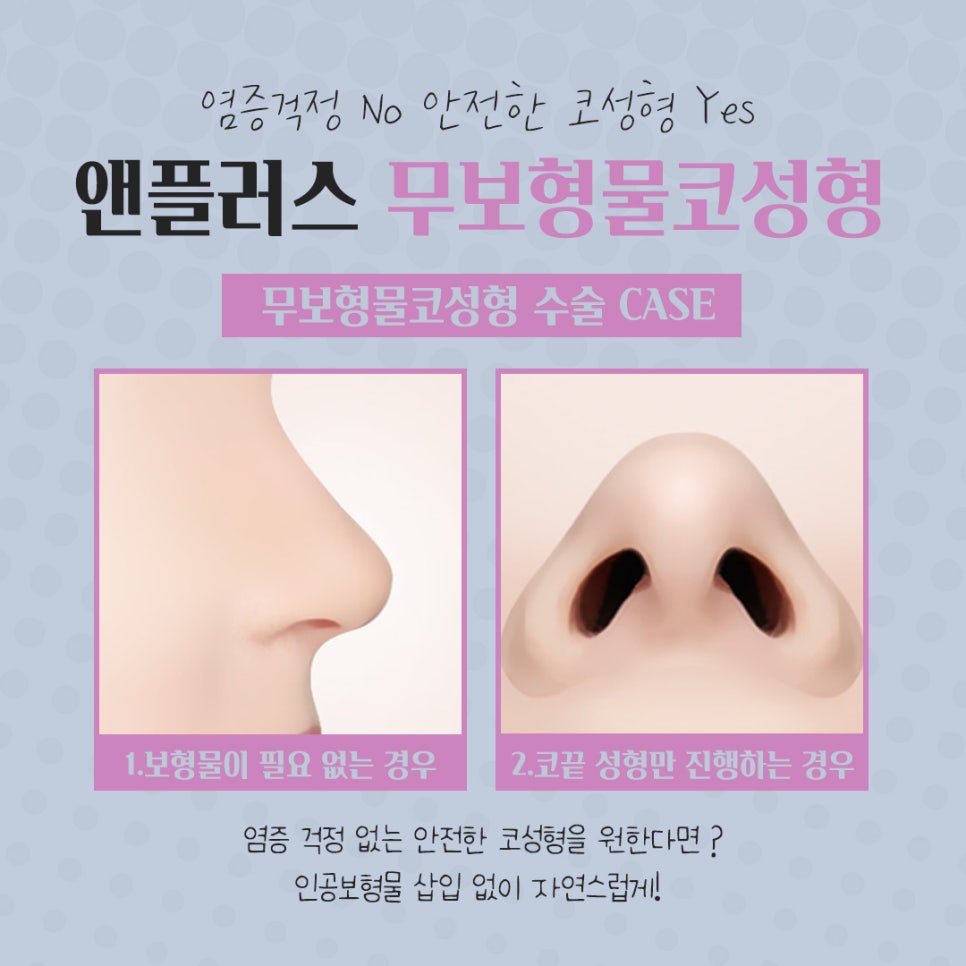 Deciding After Carefully Reviewing Non-Implant Rhinoplasty Reviews image 10