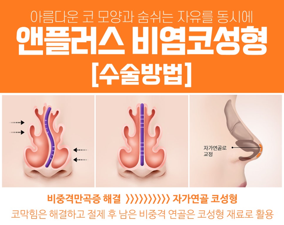 Breathing Freedom and a Beautiful Nose Shape at A+ Clinic at the Same Time image 8