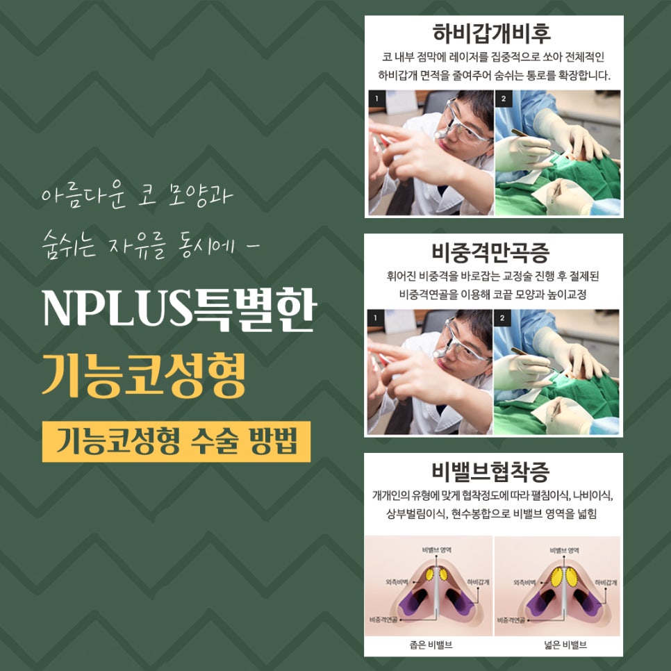 기능코성형후기 꼼꼼하게 알아보고 관련 이미지 10