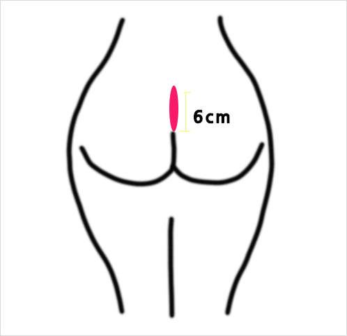 코재건 수술할때 꼭 알아두어야 할 상식! 관련 이미지 5