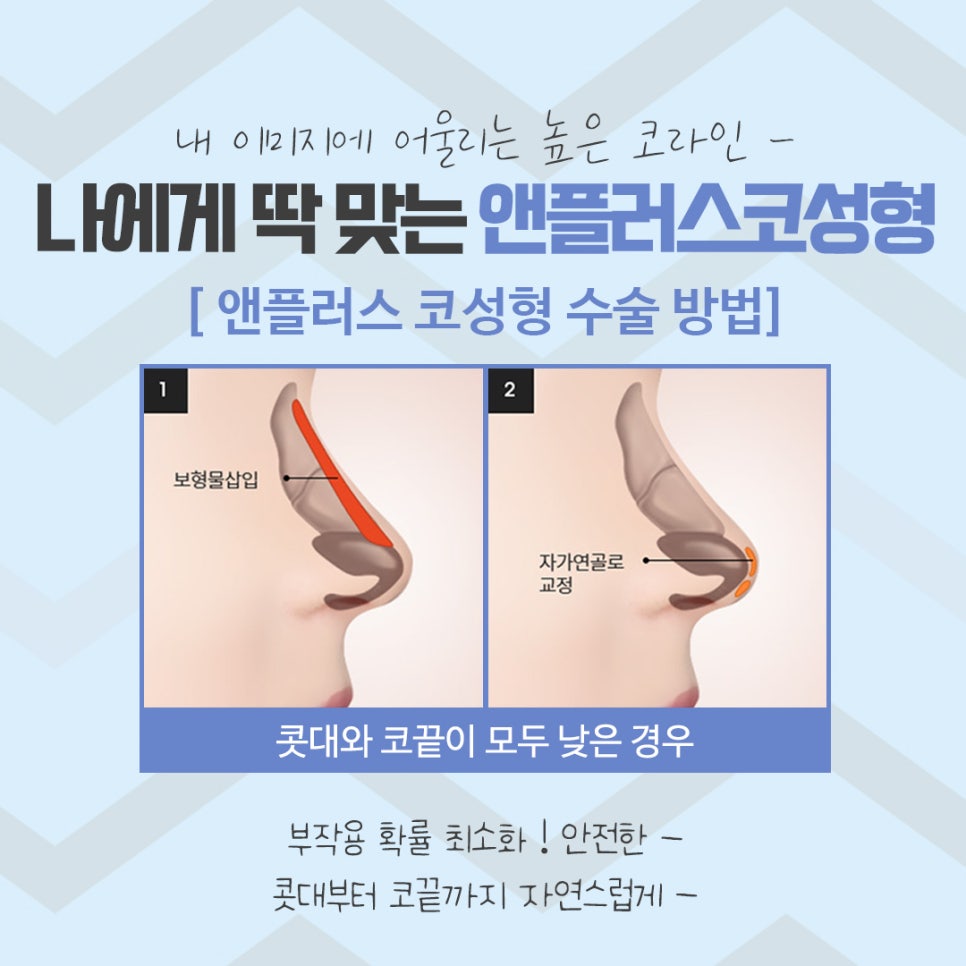 The Importance of Choosing Apgujeong Rhinoplasty image 8