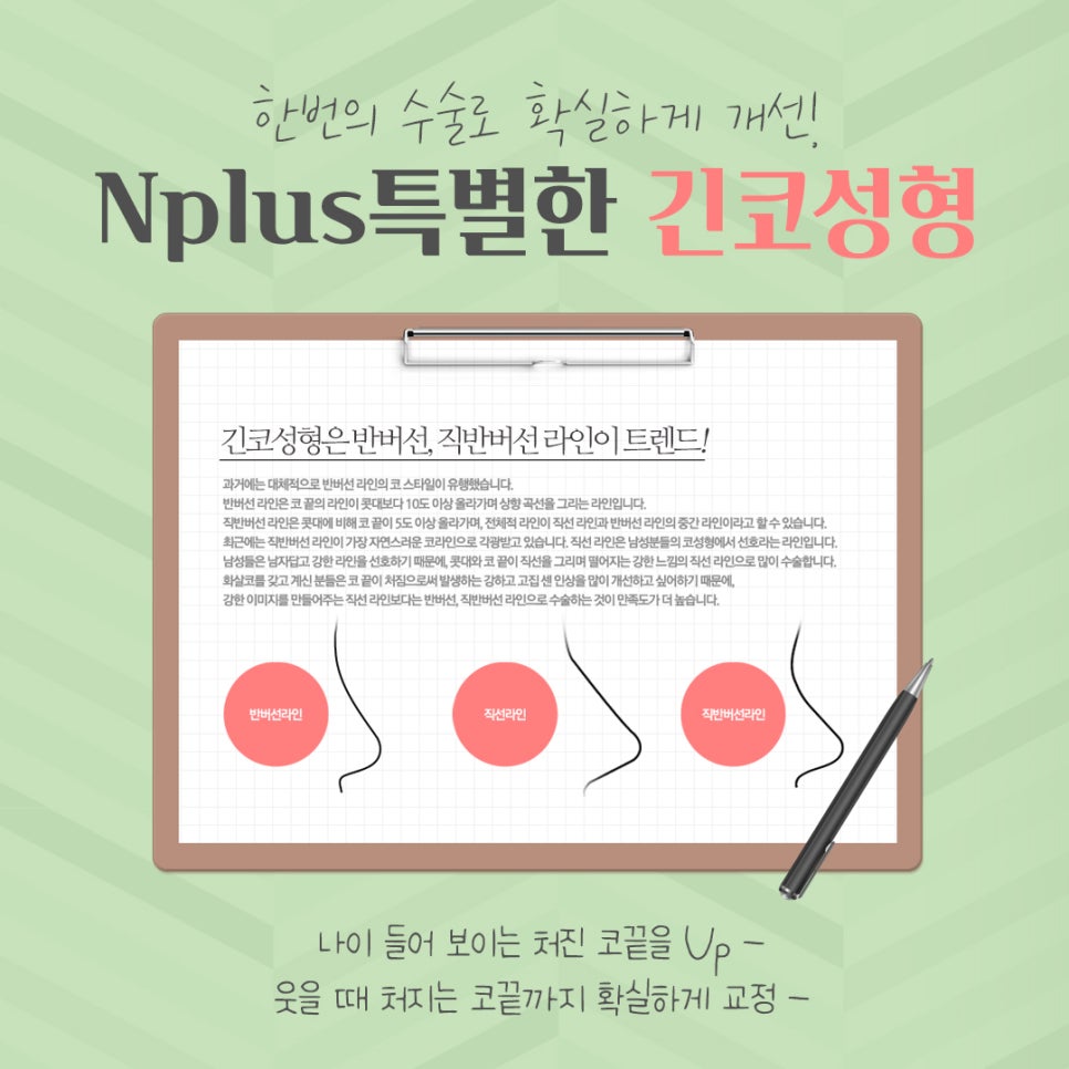 Long Nose Surgery: From Looking Older to Looking Younger image 10