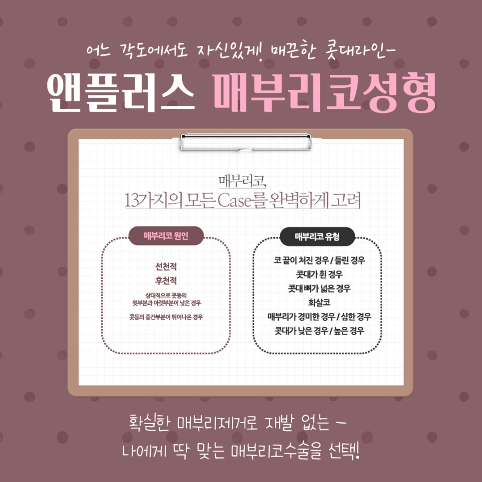 코끝처짐 개선한 매부리코성형후기 관련 이미지 5