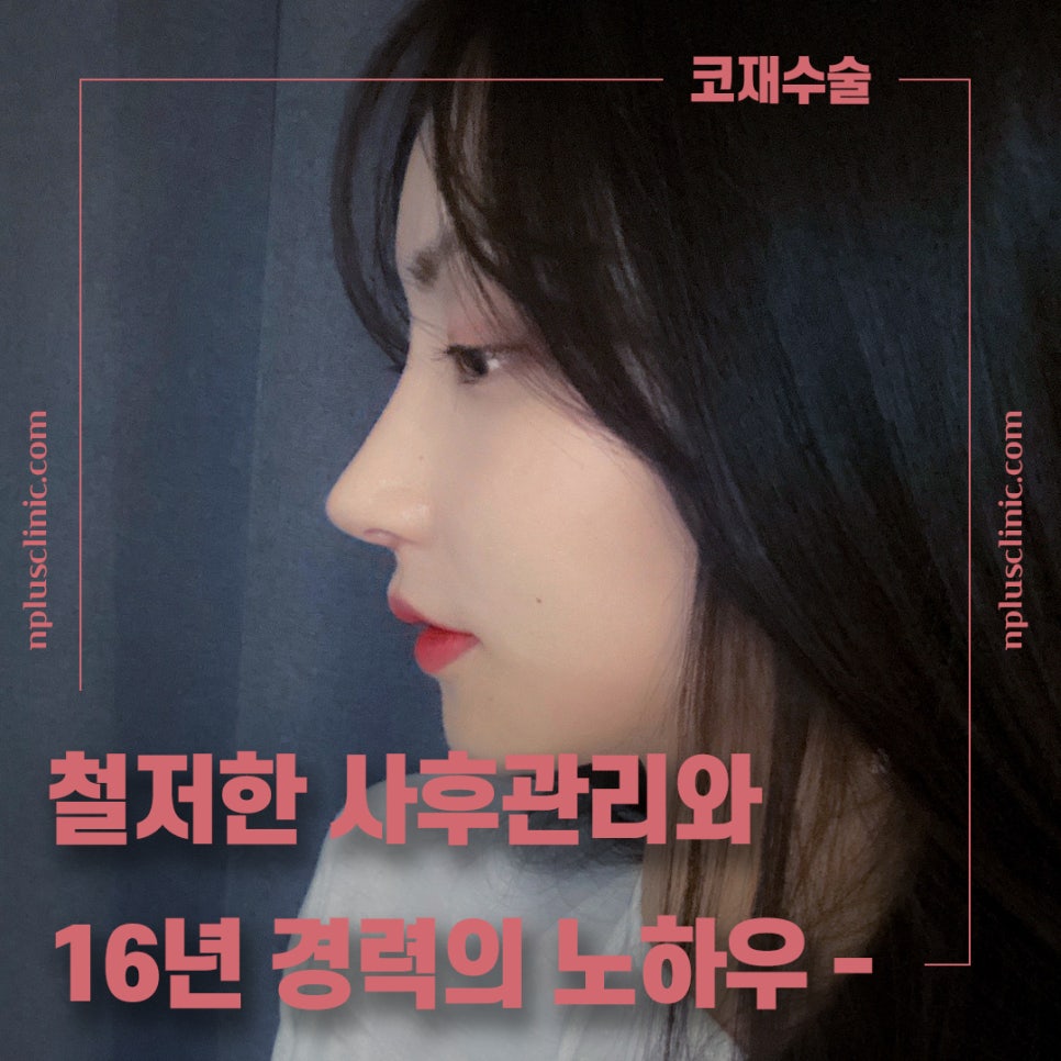 🍁가을엔 앤플러스의원 코성형 이벤트🍁 관련 이미지 8