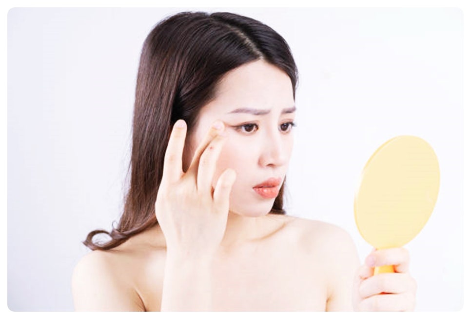 눈가주름 레이저 자연스럽게 어려보이고 싶다면? 관련 이미지 2