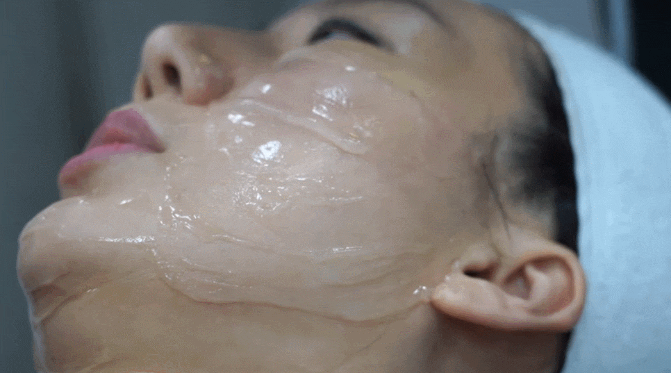 홍대인모드 요즘 가장 핫한 리프팅 시술 효과도 핫하려면? 관련 이미지 5