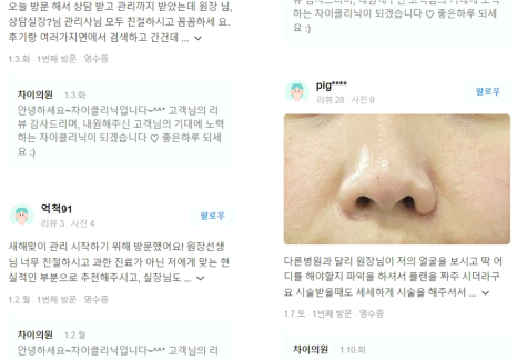 눈썹리프팅 수술 없이 시원한 눈매 완성하는 방법 관련 이미지 9