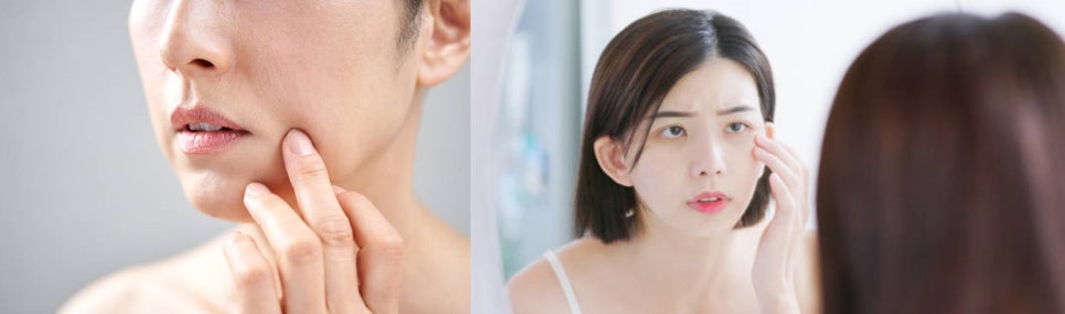 처진볼살 리프팅 힘있는 탄력으로 어려지는 피부 관련 이미지 2