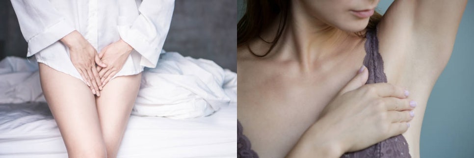 홍대여의사피부관리 늦기 전에 색소침착에서 벗어나는 법 관련 이미지 4