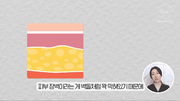 홍대 리투오 효과 높이는 조건 2가지 관련 이미지 11