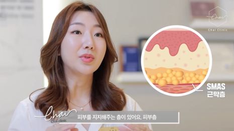 홍대울쎄라 잘 하는 곳 선택하는 기준 알려드려요 관련 이미지 6