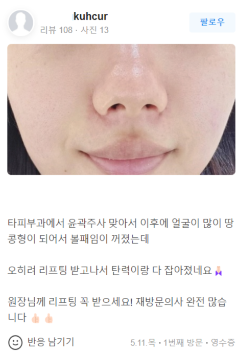 합정피부관리 인모드 잘하는곳 이것을 확인하세요 관련 이미지 30