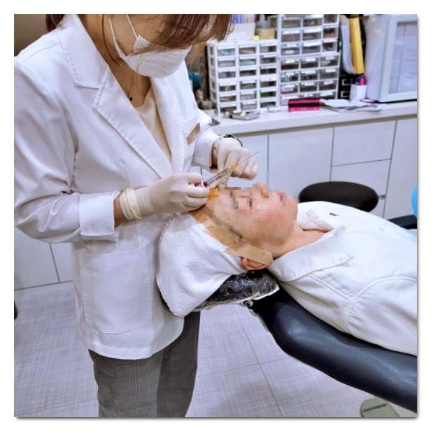 Why Do Nasolabial Fold Filler Prices Vary by Clinic? image 2