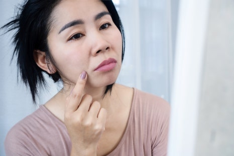 합정피부관리 인모드 잘하는곳 이것을 확인하세요 관련 이미지 2