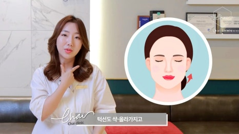 울쎄라 효과시기 제대로 보려면 &lsquo;이것&rsquo; 중요합니다 관련 이미지 7